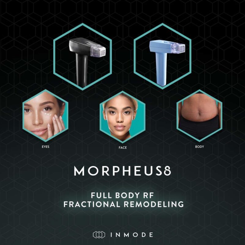 Morpheus8 in Buffalo, NY | RF Microneedling with Morpheus8